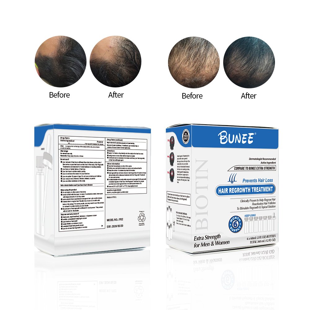 Private Label Damaged Hair Fast Growth Best Hair Regrowth Treatment Hair Growth Serum Oil For Men
