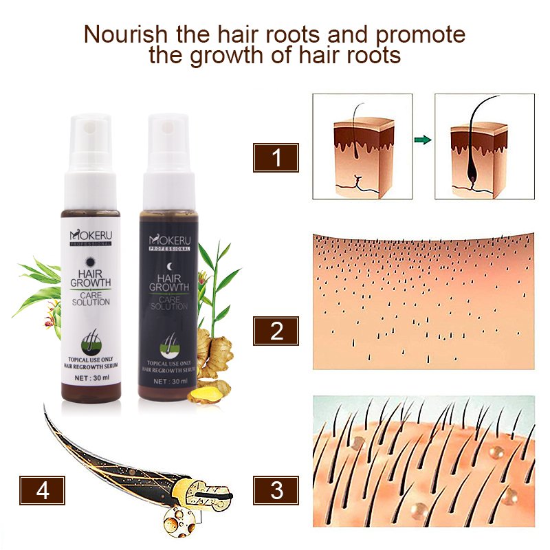 New Biotin hair tonic for hair growth organic vitamins formula cure men baldness and hair regrow