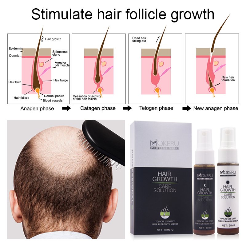 New Biotin hair tonic for hair growth organic vitamins formula cure men baldness and hair regrow
