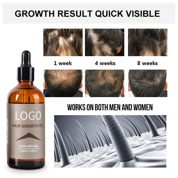 OEM 30ml popular Hair Regrowth oil Ginger Extract rosemary tea tree essential oil natural real Hair regrowth oil