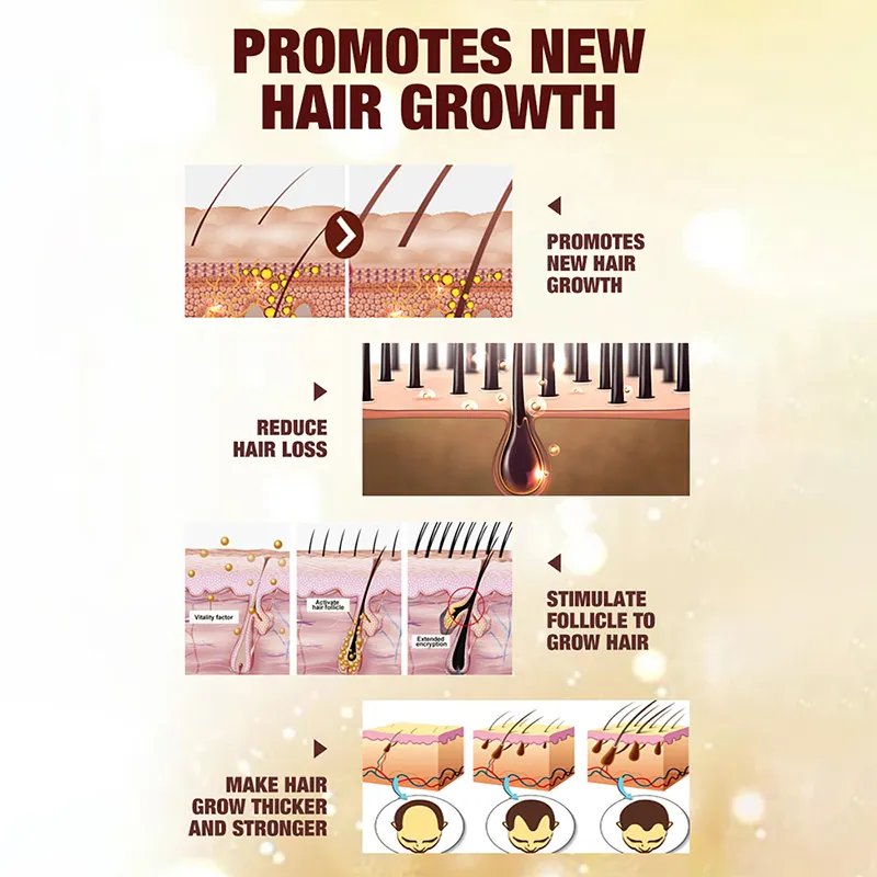 OEM 30ml popular Hair Regrowth oil Ginger Extract rosemary tea tree essential oil natural real Hair regrowth oil