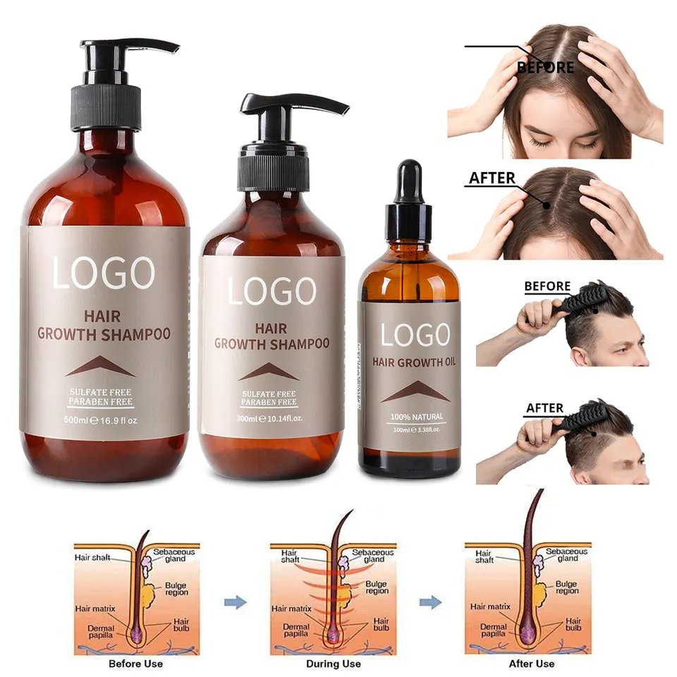 OEM 30ml popular Hair Regrowth oil Ginger Extract rosemary tea tree essential oil natural real Hair regrowth oil