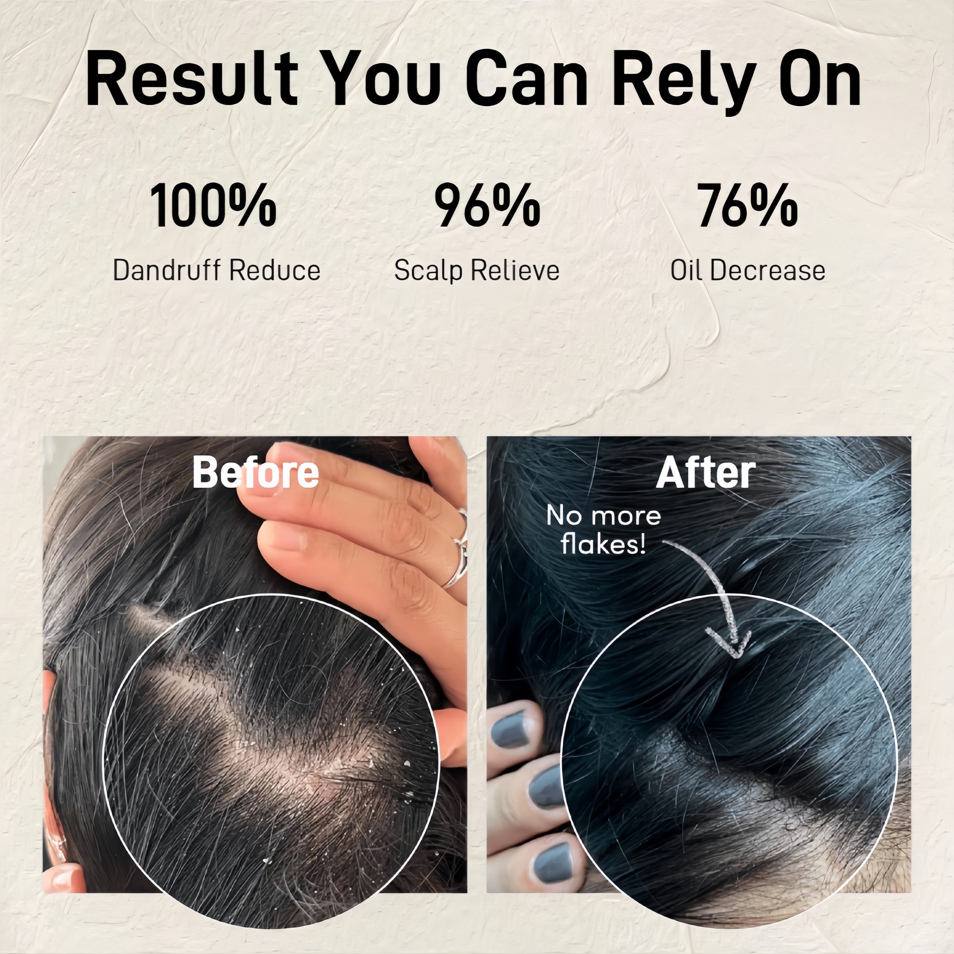 Daily Hair Washing Used Plant Fragrance Salicylic Acid Dandruff Clear Shampoo For Adults