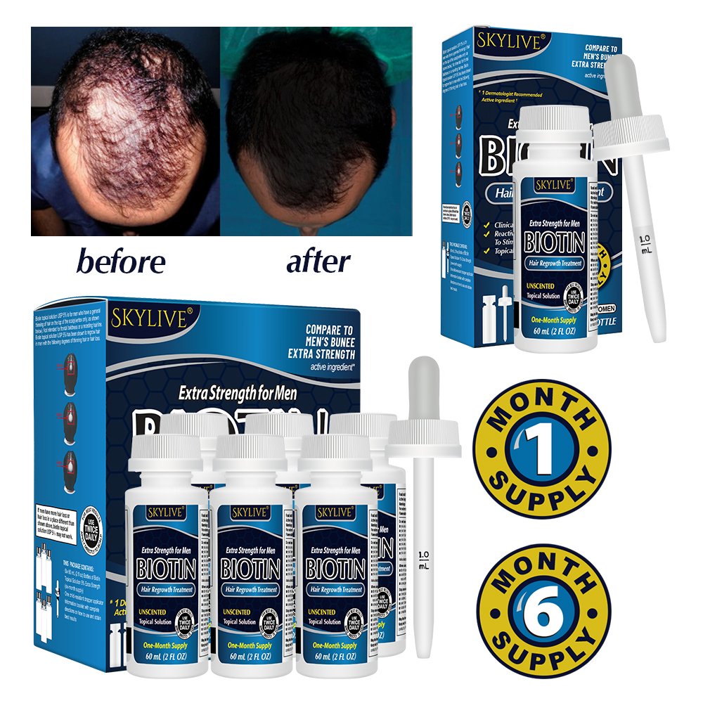 OEM Private Label Anti Hair Loss Hair Tonic Hair Growth For Men