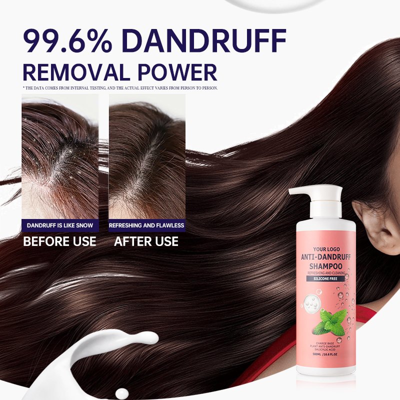 OEM ODM High Quality Hair Shampoo For Dandruff Private Label Professional Refreshing Mild Cleansing Anti Dandruff Shampoo