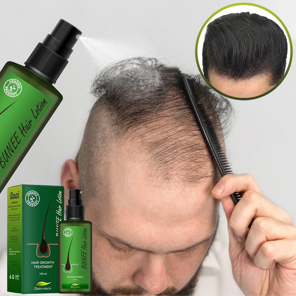 Hair Regrowth Treatment Thailand Hair Growth Tonics Biotin Hair Loss Solution Spray