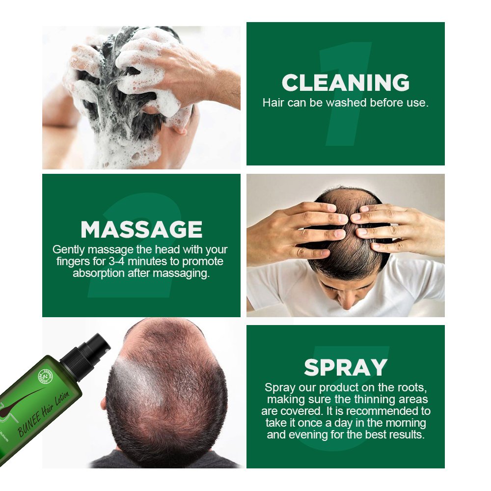 Hair Regrowth Treatment Thailand Hair Growth Tonics Biotin Hair Loss Solution Spray