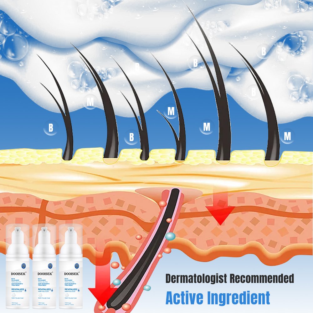 Hot Products Men's Topical Solution Anti- Hair Loss Treatment Hair Regrowth Oil Biotin Serum kirland hair growth foam