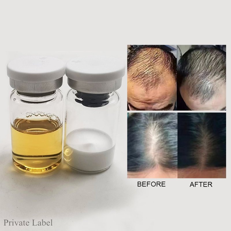 Hair Regrowth Meso Mesotherapy Micro-needling hair regrowth men and women Anti hair loss lotion