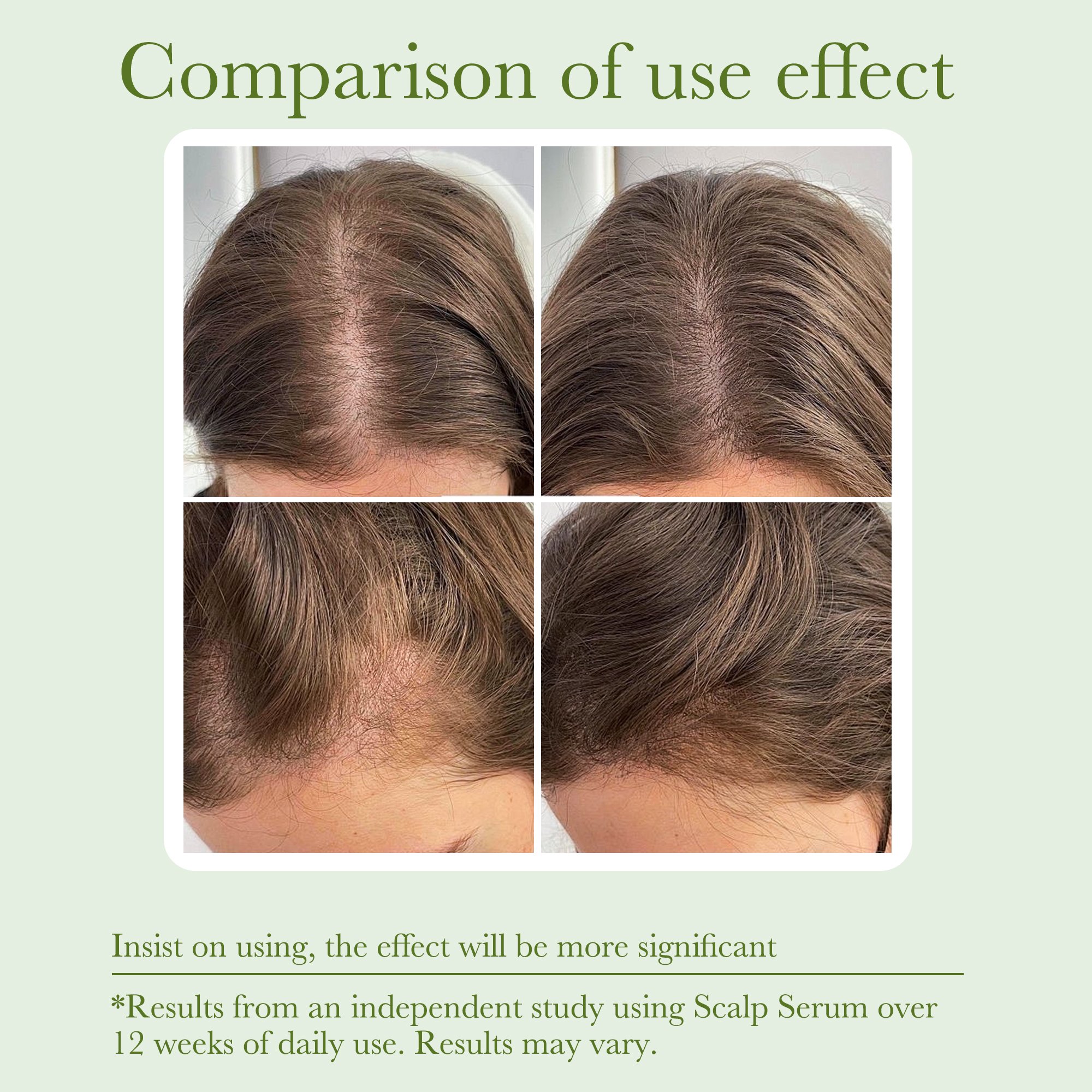 Private Label Vegan Organic Rosemary Caffeine Tea Tree Men Women Scalp Care Serum Hair Treatment Growth Oil