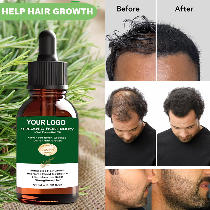 Hot Sale Fast Hair Growth Treatment Oil Hair Growth Serum Tonic 60ml Rosemary Hair Growth Oil