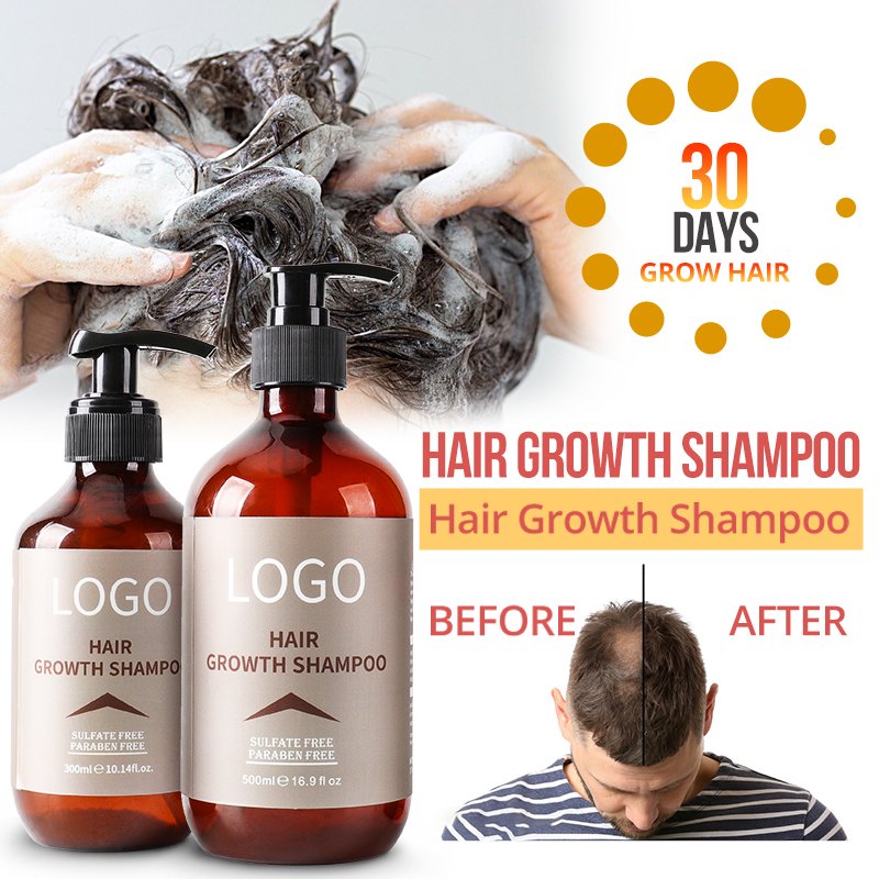 Custom Logo Rice Water Hair Growth Shampoo Biotin Infused Hairs Soothing Nourish Anti Hair Loss Rice Shampoo For Men And Women