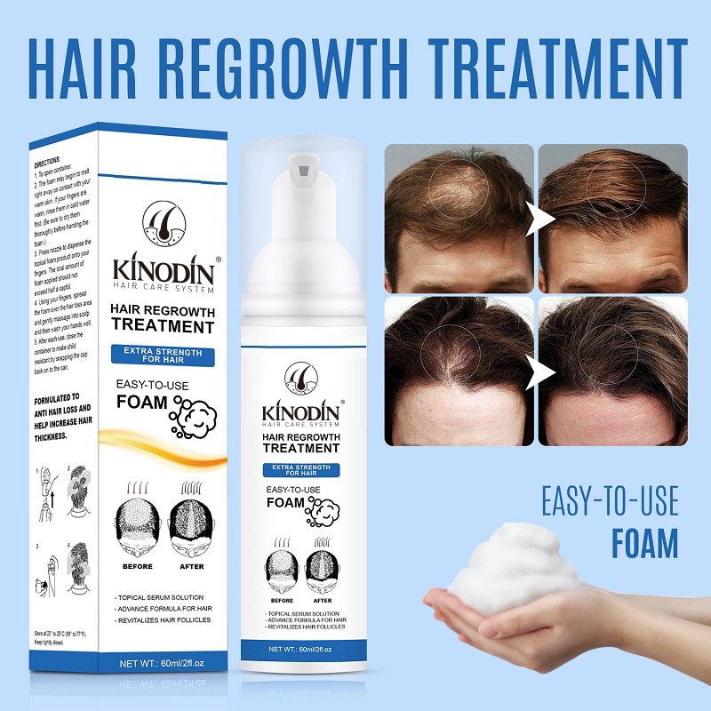 KINODIN Men's Topical Solution Anti- Hair Loss rogain Treatment Hair Regrowth Oil Biotin Serum hair growth foam