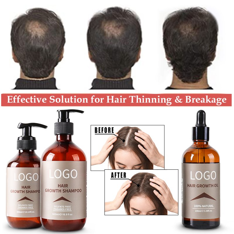 Manufacturer Fast Hair Growth Ginger Anti-Dandruff Organic Tea Tree Oil Shampoo And Conditioner Set