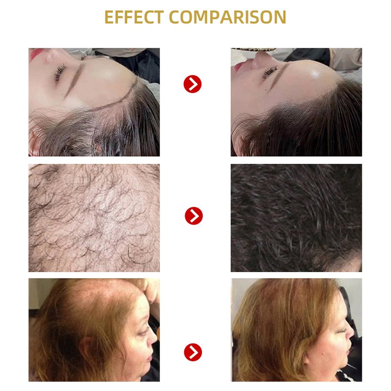 1 liter ginseng Anti-hair loss tonic for Hair Loss Treatment Hair Growth Serum