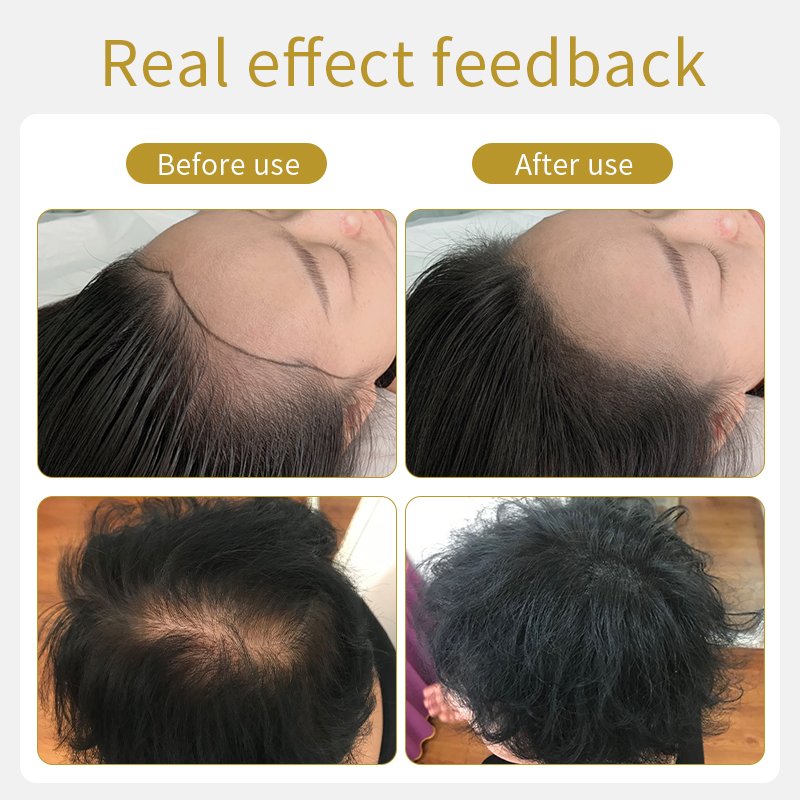 1 liter ginseng Anti-hair loss tonic for Hair Loss Treatment Hair Growth Serum