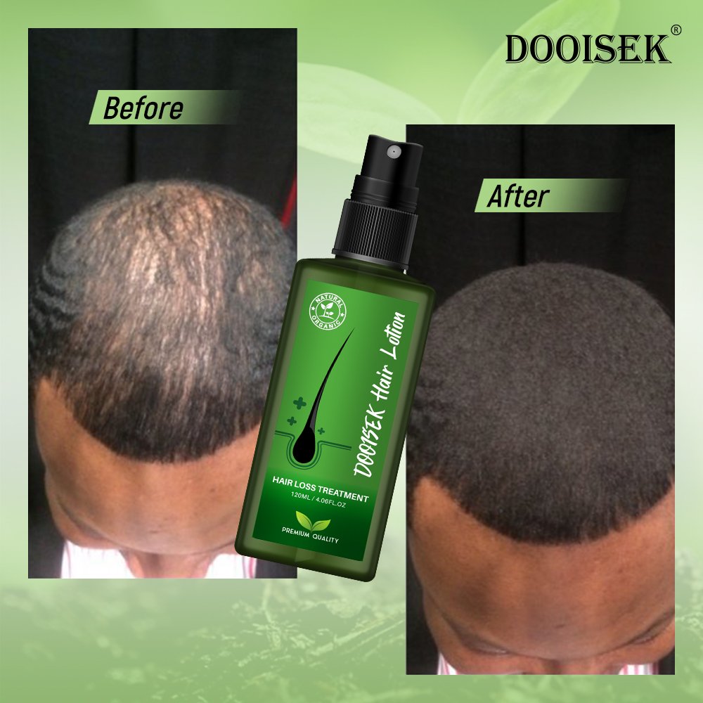 Private Label Hair loss regrowth treatments serum 120ml hair growth liquid scalp spray oil solution hair lotion thailand