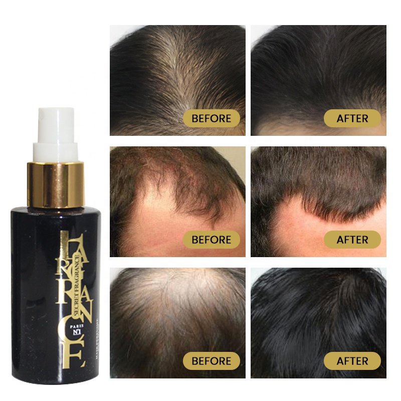 OEM Private Label Hot sale Hair Regrowth Treatments Serum Organic Ginger Platycladus Hair Regrowth Serum