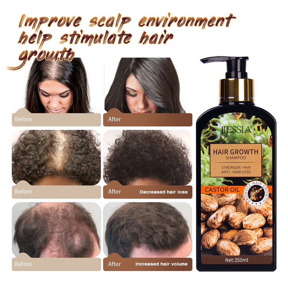 Hair Growth Shampoo And Conditioner Private Label Professional Salon Products ginger Castor Oil organic hair growth shampoo