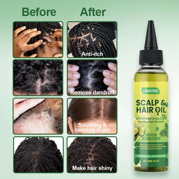 Unatree Hair Care Oil Promote Hair Growth Dandruff Relief Prevent Itching Treatment Hair Scalp Oil