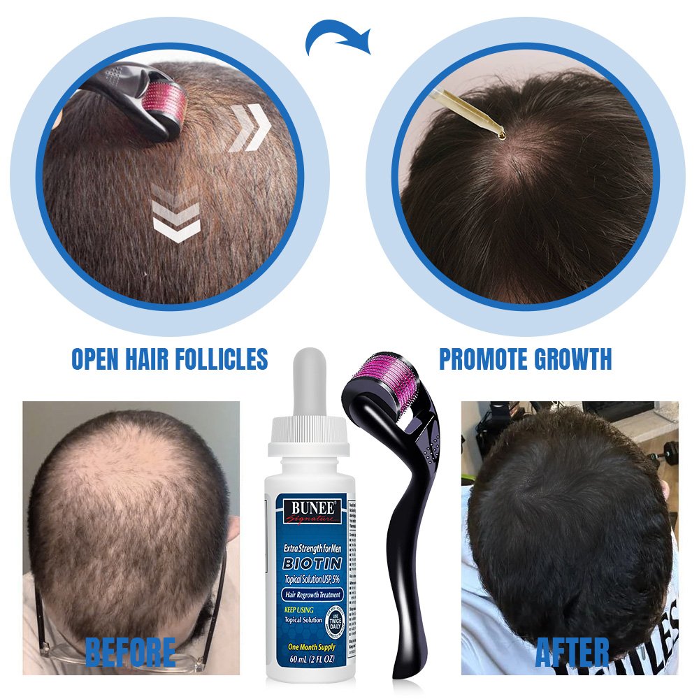 Kirland 5% Hair Growth Oil 60ml Tonic Serum Hair Regrowth Product Organic Biotin Serum