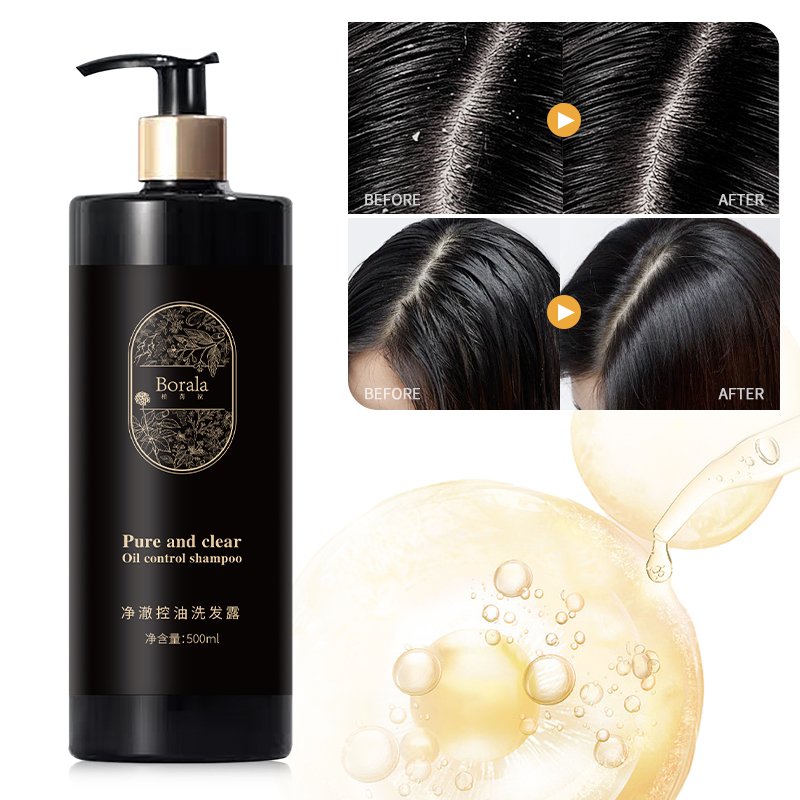 Shampoo Natural Hair Grow Shampoo Anti Hair Loss Shampoo Hair Growth