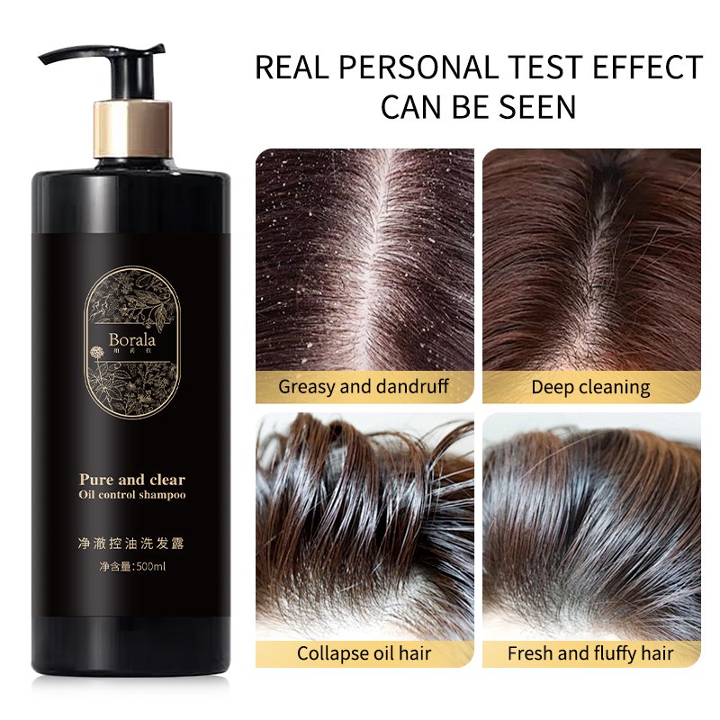 Shampoo Natural Hair Grow Shampoo Anti Hair Loss Shampoo Hair Growth
