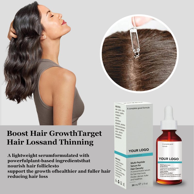 private label biotin in 14 days hair loss ginger custom hair regrowth product for men tonic to grow hair