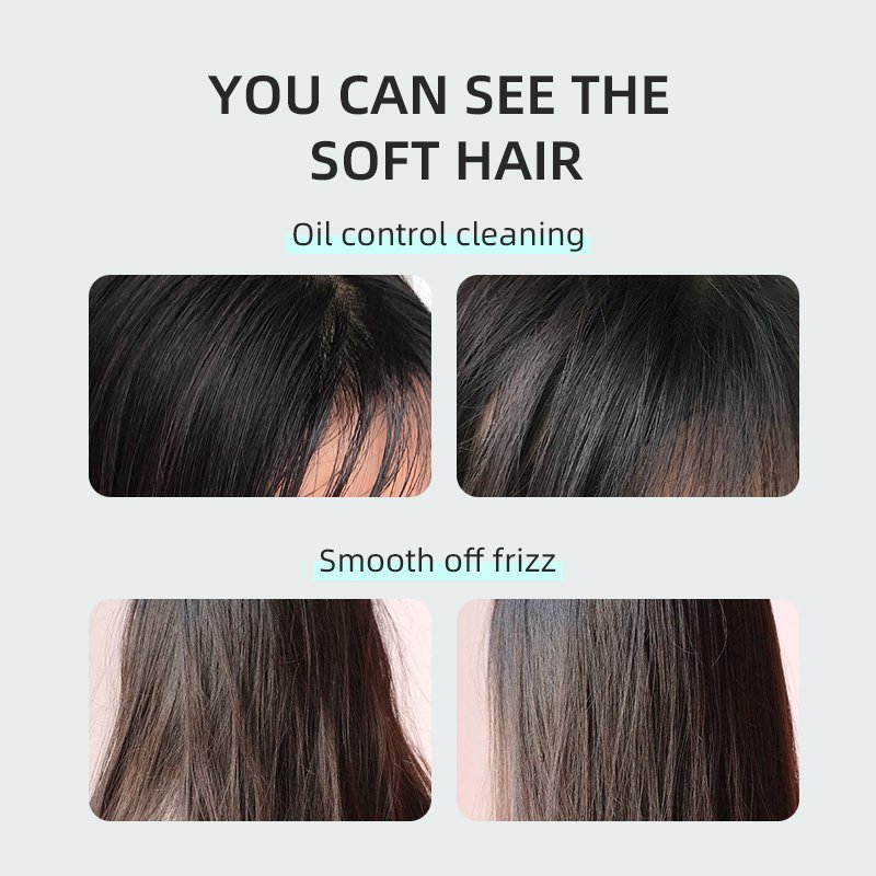 Hot selling amino acid ester free oil control shampoo is used for oily hair to resist dandruff, moisturize and improve itching