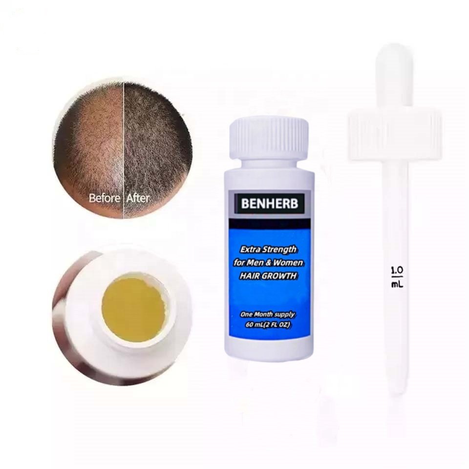 60ML 5% Hair Regrowth Oil Hair Care Loss Treatment Hair Growth Serum Kit for men