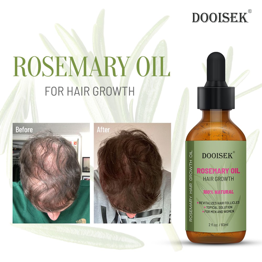 Wholesale Herbals Hair Tonic Liquid Hair Regrowth Anti Hairloss Serum Hair Growth Essential Oil Spray OEM