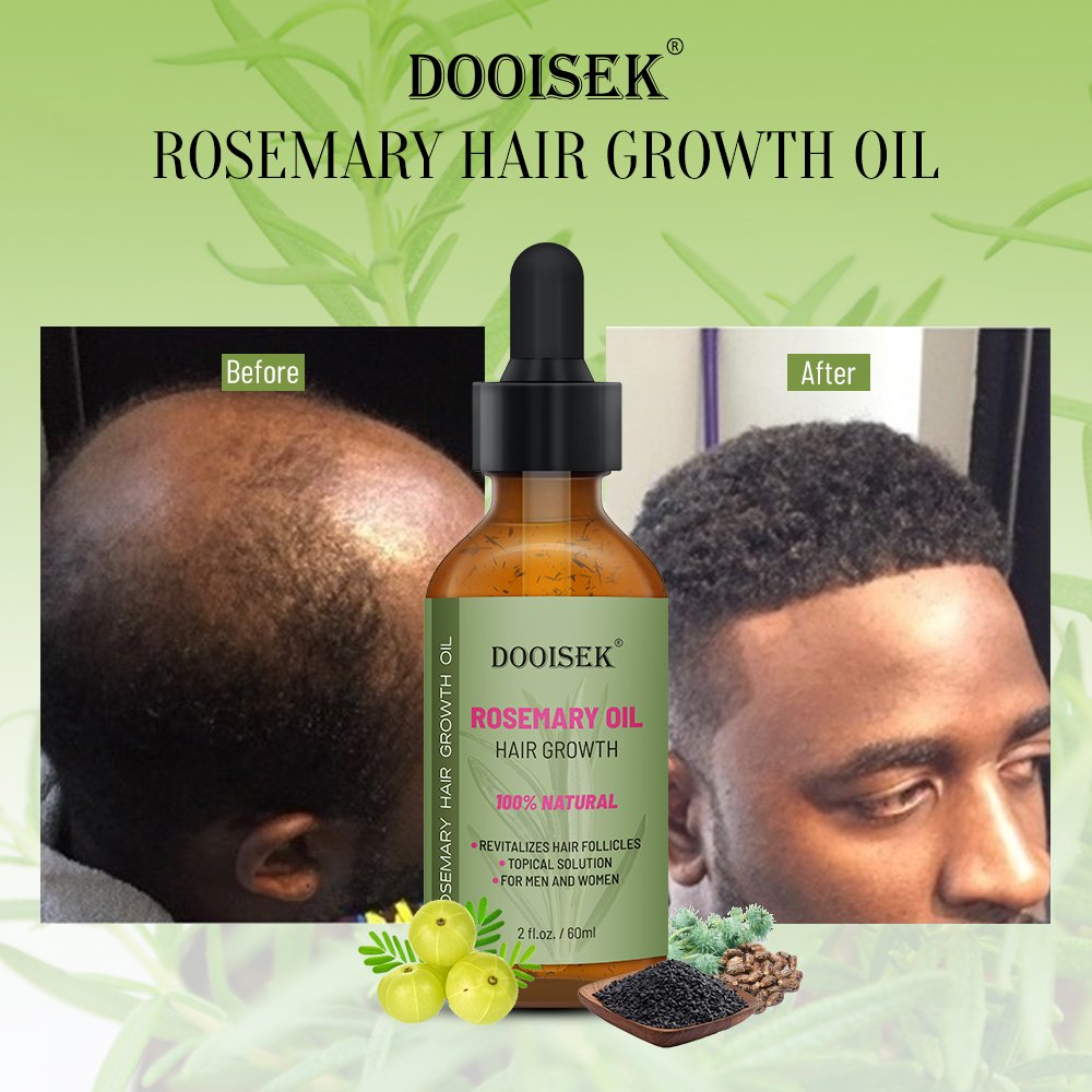 Wholesale Herbals Hair Tonic Liquid Hair Regrowth Anti Hairloss Serum Hair Growth Essential Oil Spray OEM