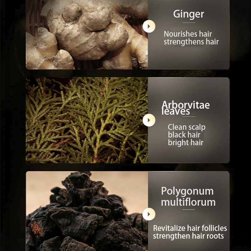 Bulk In Stock Fast Delivery Nourishing Hair-Repairing Ginger Anti Hair Loss Dandruf Shampoo