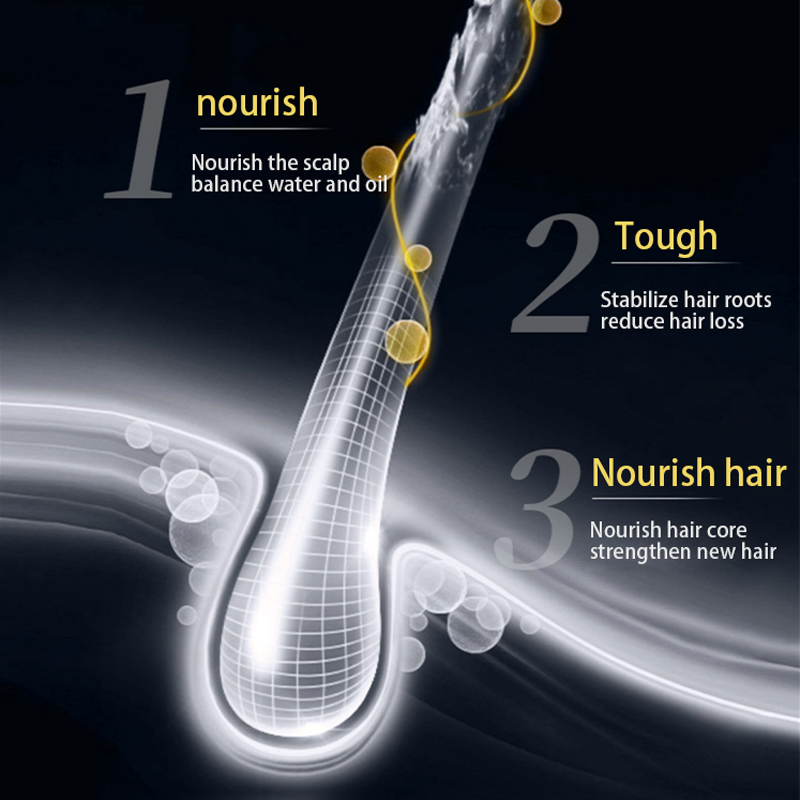 Bulk In Stock Fast Delivery Nourishing Hair-Repairing Ginger Anti Hair Loss Dandruf Shampoo