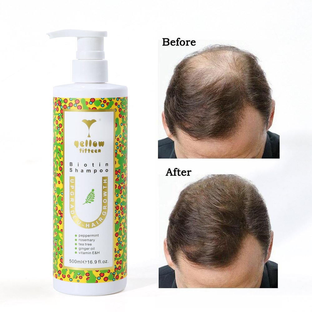 Wholesale rosemary hair products moisturizing treatment ginger nourishing biotin tea tree oil hair growth shampoo