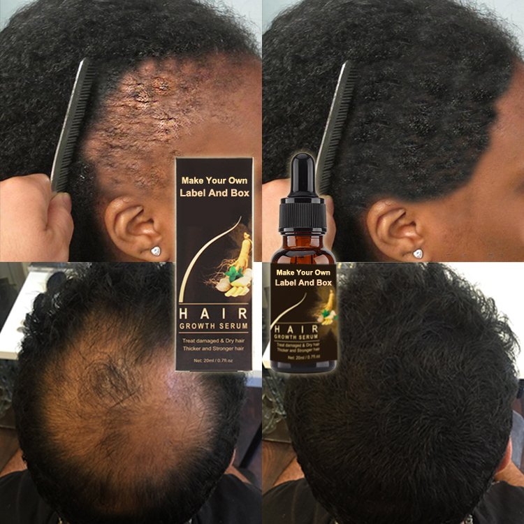 Create Your Label Smoothing Nourishing Anti Loss Regrowth Scalp Elixirs Private Label Hair Growth Oil Serum MSDS. ISO