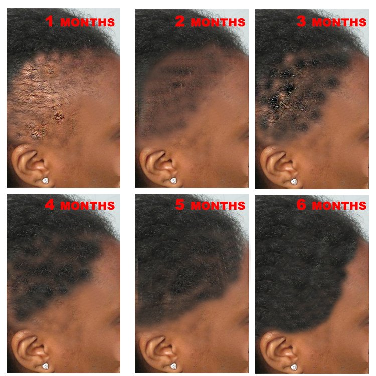 Create Your Label Smoothing Nourishing Anti Loss Regrowth Scalp Elixirs Private Label Hair Growth Oil Serum MSDS. ISO