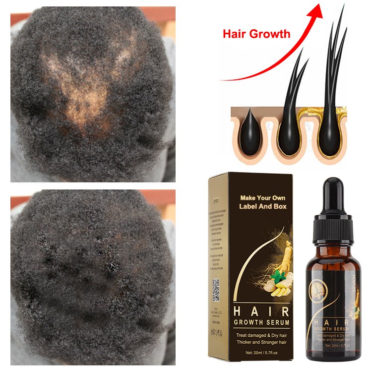 Create Your Label Smoothing Nourishing Anti Loss Regrowth Scalp Elixirs Private Label Hair Growth Oil Serum MSDS. ISO