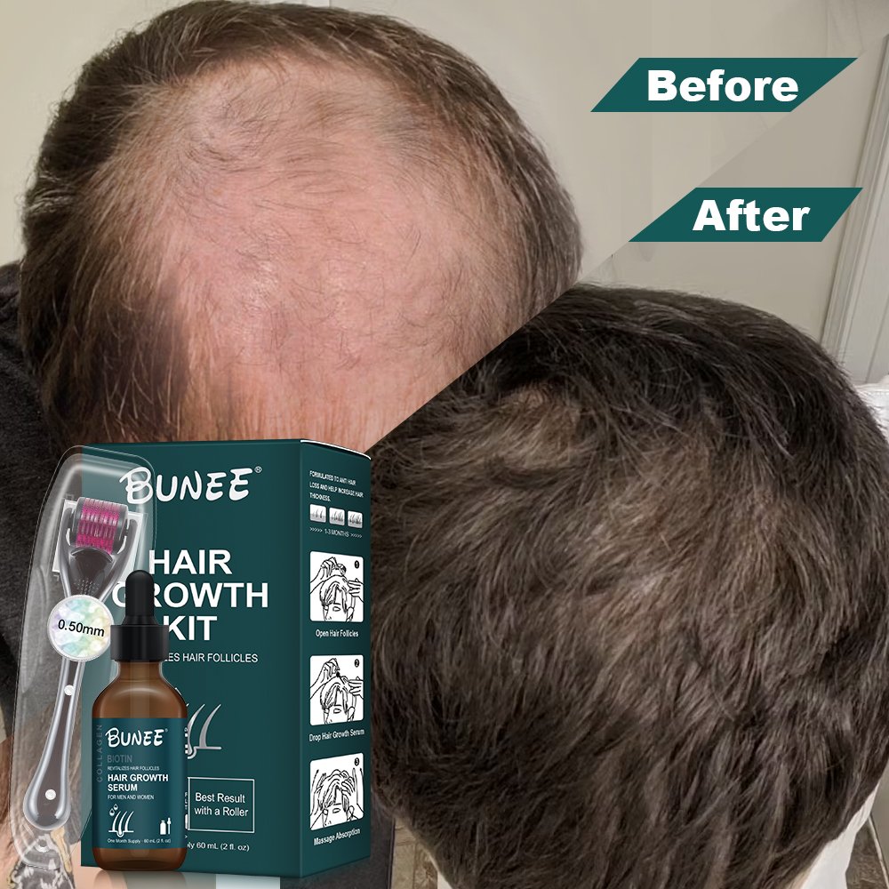 Fast result BUNEE Topical HAIR Essence Regrowth Biotin HERBAL HAIR TONIC hair growth serum oil