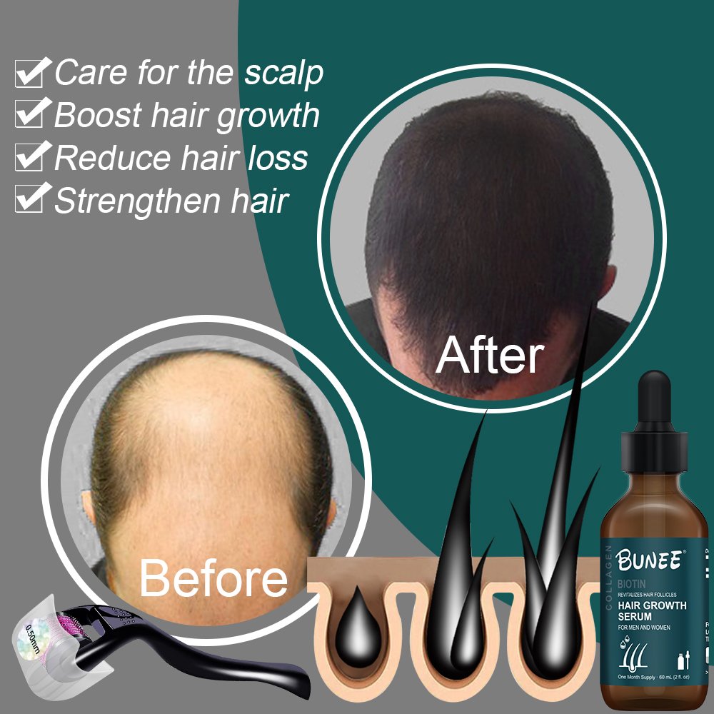 Fast result BUNEE Topical HAIR Essence Regrowth Biotin HERBAL HAIR TONIC hair growth serum oil