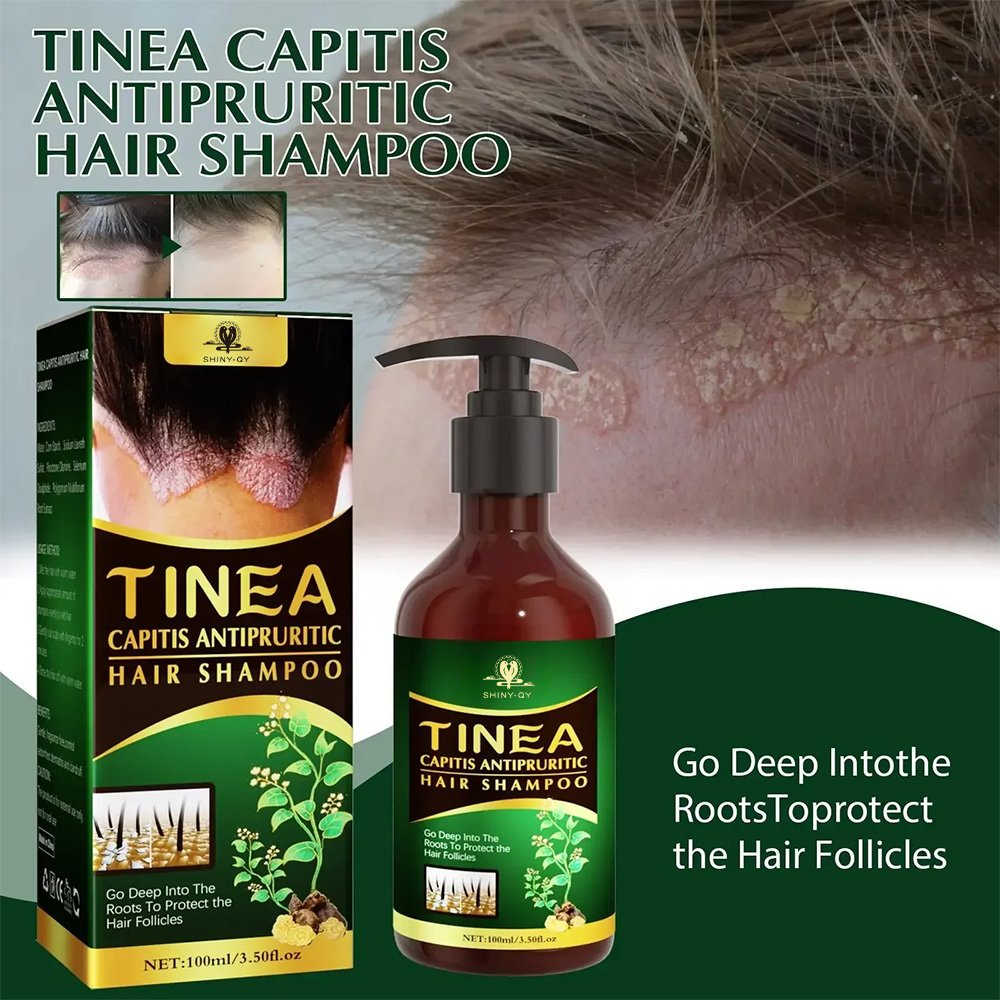 Manufacturers Hair Dye Care Antipruritic Antidandruff Oil Control Shampoo For Hair