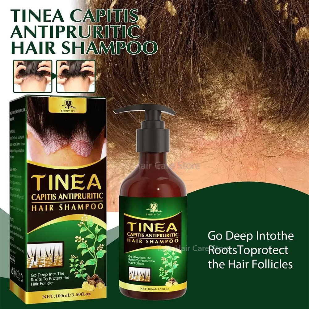 Manufacturers Hair Dye Care Antipruritic Antidandruff Oil Control Shampoo For Hair