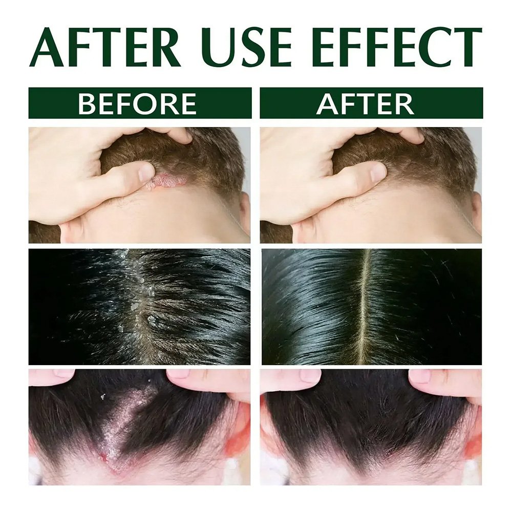 Manufacturers Hair Dye Care Antipruritic Antidandruff Oil Control Shampoo For Hair