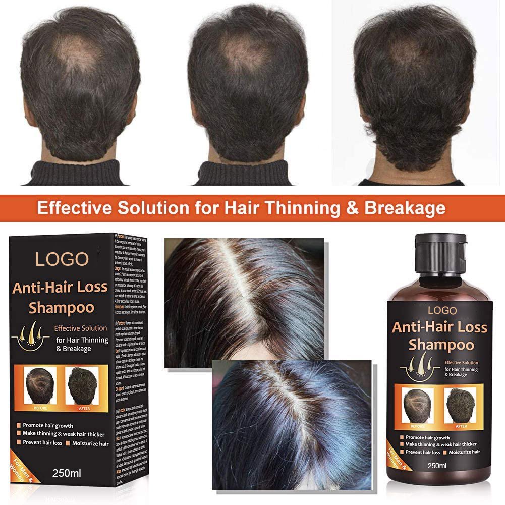 Private Label Organic Anti Hair Loss Hair Shampoo Hair Growth Shampoo