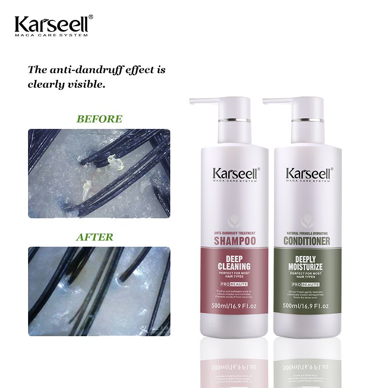 Karseell Prival Label OEM Manufacture Best Organic Shampoo for Damaged Hair Moisture Anti Dandruff Shampoo