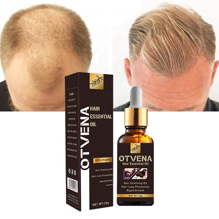 Quick regrowth hair anti baldness treatment OTVENA hair growth oil