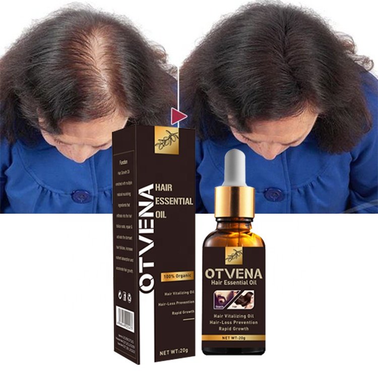 Quick regrowth hair anti baldness treatment OTVENA hair growth oil