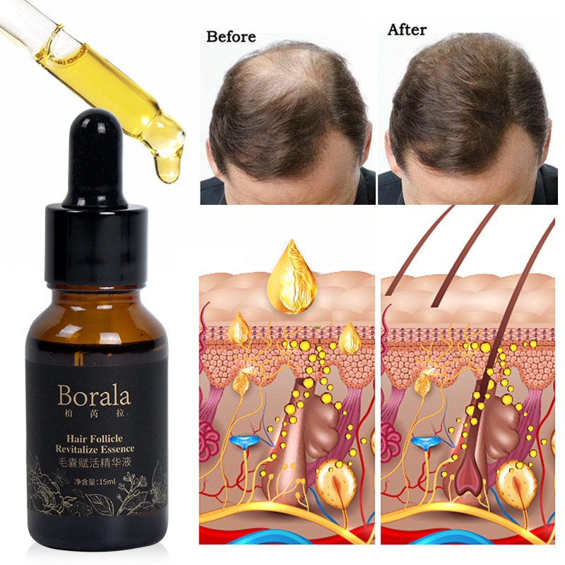 Hair Regrowth Treatments Hairline Serum Scalp Follicle Stimulation Essence borala