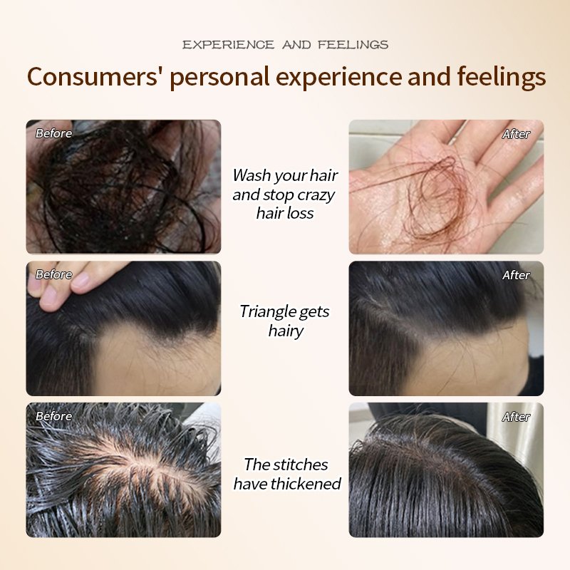 Hair Regrowth Treatments Hairline Serum Scalp Follicle Stimulation Essence borala