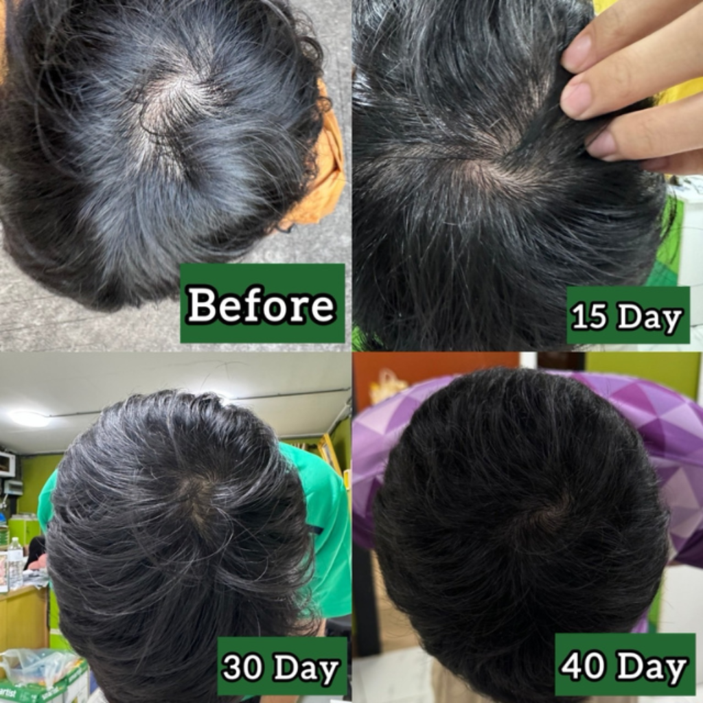 Top Seller Organic Hair Growth Oil Serum Spray Nutrient Refreshing Nourishing for Men Women Kids Hair-Loss Prevention Feature